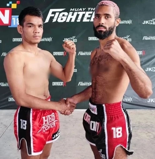 แพทย์เผยสาเหตุ ปานเพชร น็อกหมดสติ อาการโคม่า ไม่ได้เกิดจากศอก