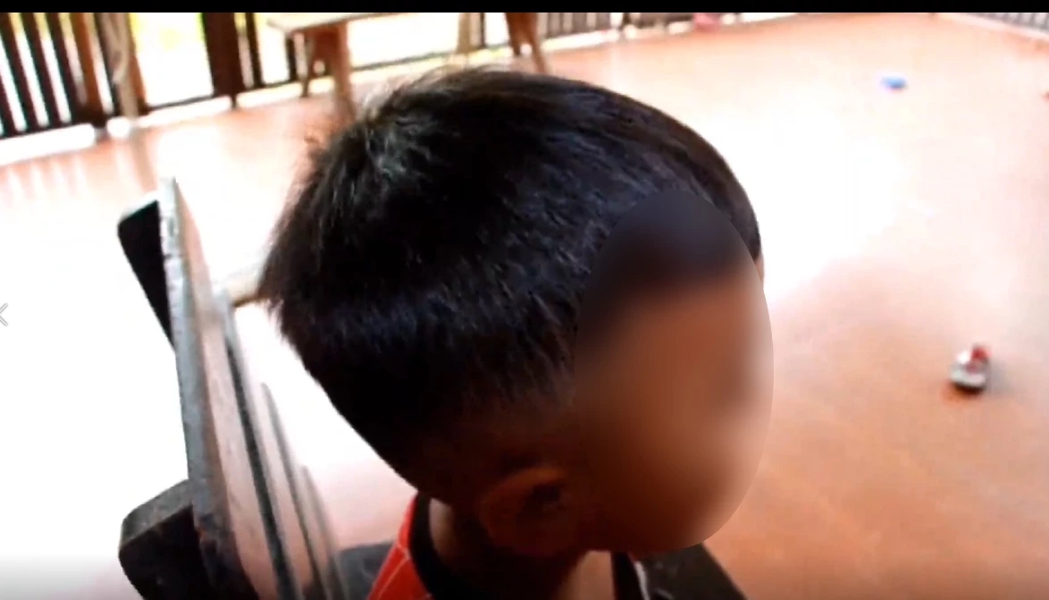 "ครู" ใช้ถาดหลุมตีหัว "เด็กอนุบาล" ป่วยลมชักจนผวาไม่อยากไปเรียน