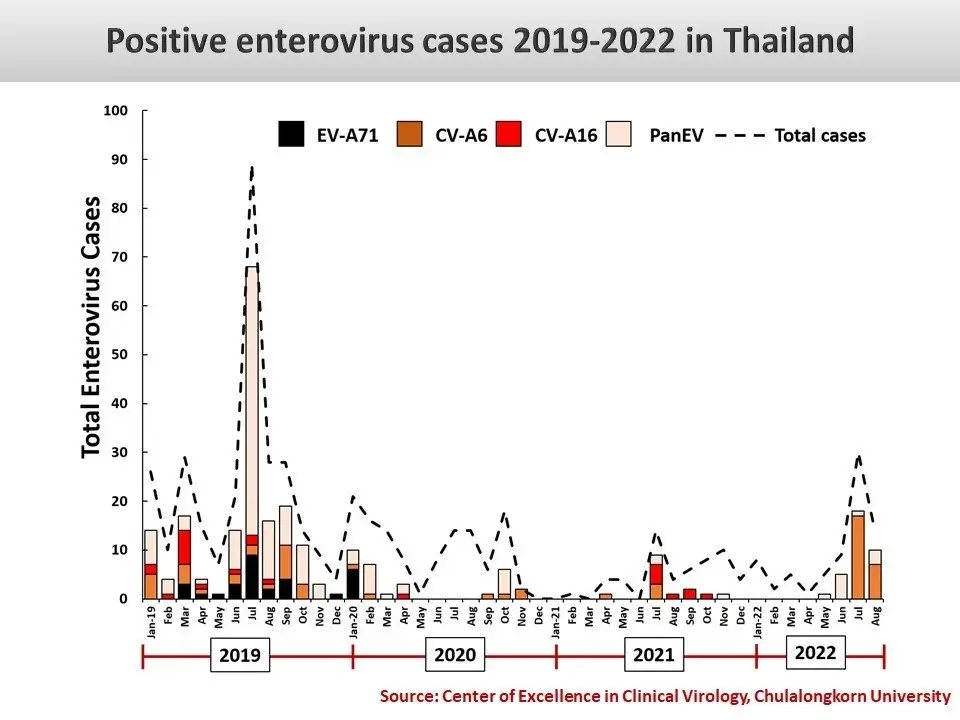 เตือน“โรคมือเท้าปาก” หมอยง ชี้สายพันธุ์อันตราย EV-A71 ทำป่วย"สมองอักเสบ"