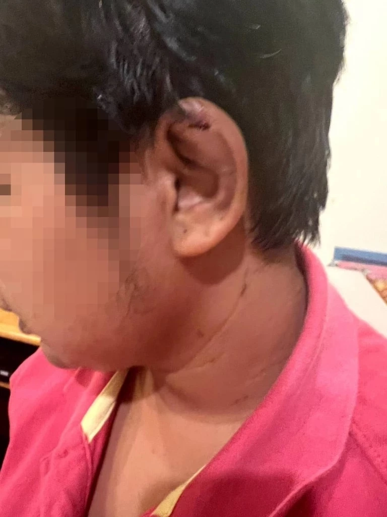 สันติบาล รอผลสอบ ส.ต.ท.หญิงทำร้ายอดีตทหารรับใช้ ก่อนสรุปบทลงโทษ