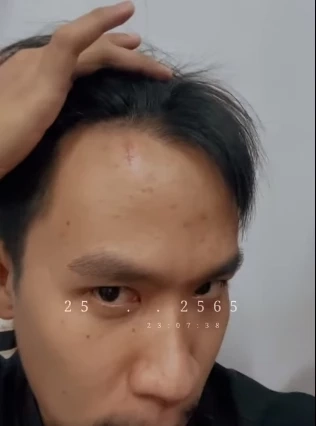 ชนสนั่นรถตู้ "เนม สุรพงศ์” นักร้องดัง เกิดอุบัติเหตุพังยับ รอดตายหวุดหวิด