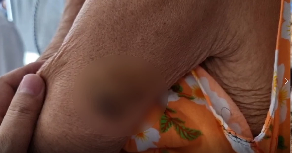 สะเทือนใจ ! เข้าช่วยยาย 94 ปี ถูกลูกสาวดุด่าทุบตี อ้างแม่ดื้อเหนื่อยดูแล