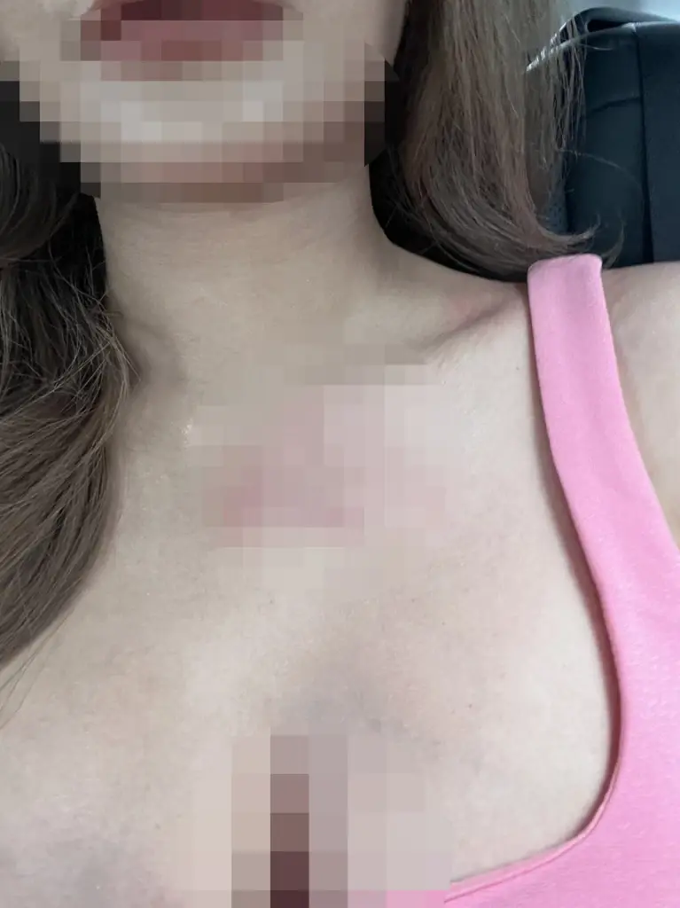สาวไฮโซ ร้องกระทรวงยุติธรรม ถูกอดีตสามีทำร้าย - ข่มขู่