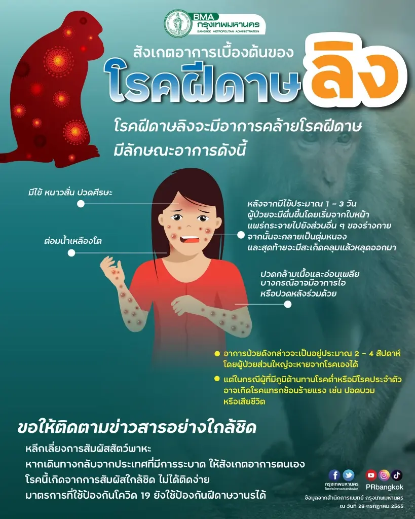 กทม. เตรียมแผนเผชิญเหตุ โรคฝีดาษลิง พร้อมสร้างความเข้าใจ-แนวทางป้องกัน