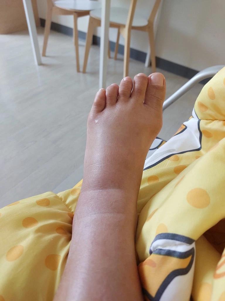 สาวโวย ถูกงูกัดในห้างดังย่านบางแค ห้างไม่รับผิดชอบบอกไม่ใช่เจ้าของงู