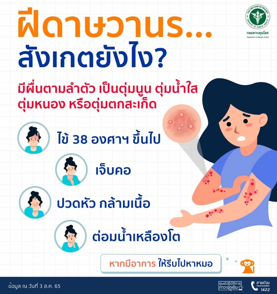 หมอยง เปิดข้อมูล "ฝีดาษลิง" เหตุใดตุ่มจึงขึ้นบริเวณอวัยวะเพศ และป้องกันยาก