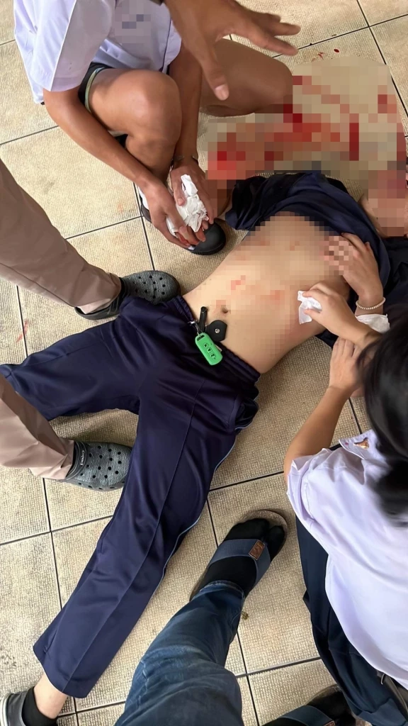 มัธยมยานนาวา เปิดแมตช์ชิงสนามฟุตบอล นองเลือดจำนวน 2 ราย