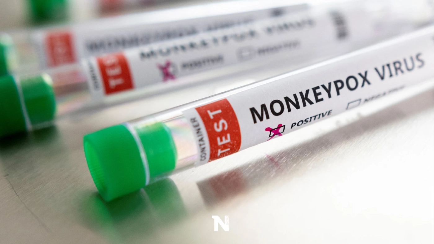 กรมการแพทย์ เปิดแนวทางการรักษา "ฝีดาษลิง" ล่าสุดไทยพบผู้ป่วยรายที่สาม