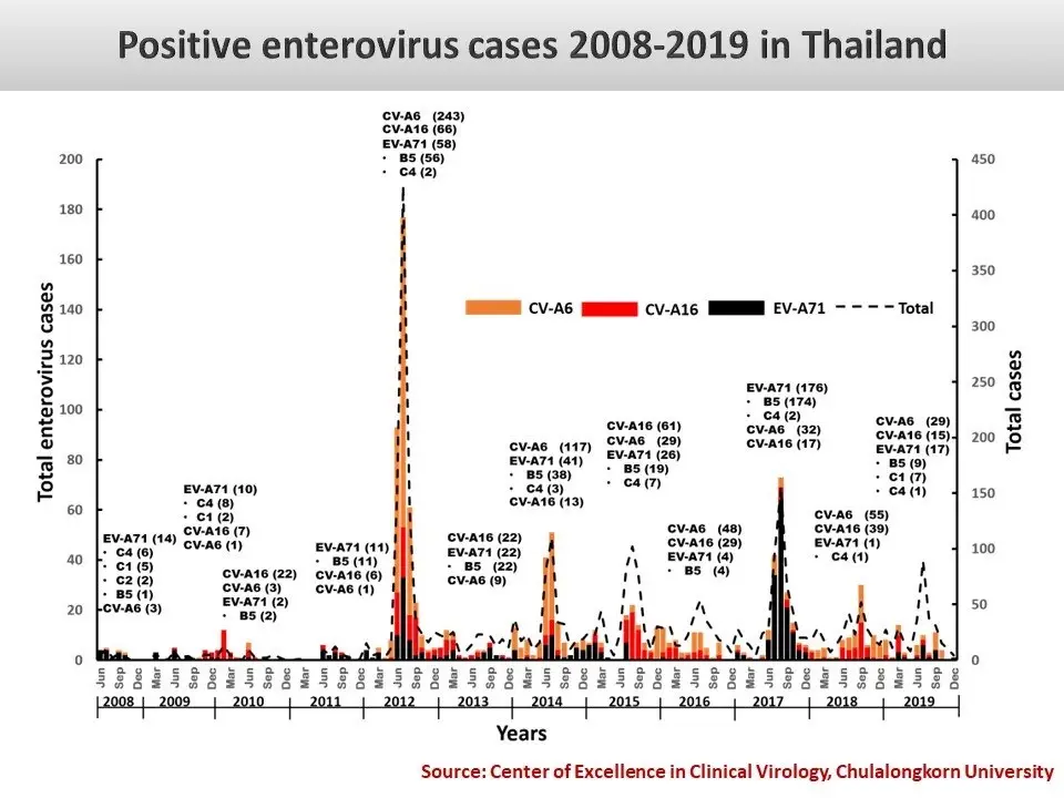 เตือน“โรคมือเท้าปาก” หมอยง ชี้สายพันธุ์อันตราย EV-A71 ทำป่วย"สมองอักเสบ"
