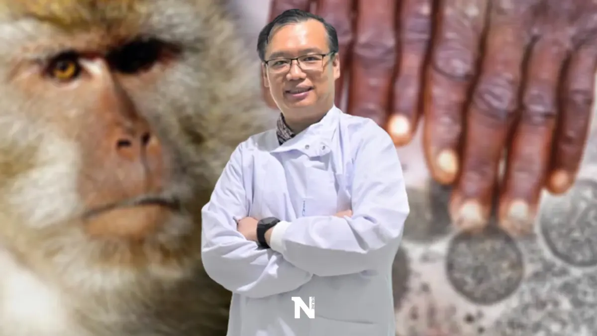 ข่าวดี! ฉีดวัคซีนหลังเสี่ยงสูงติดเชื้อ "ฝีดาษลิง" ลดความรุนแรงของโรคได้