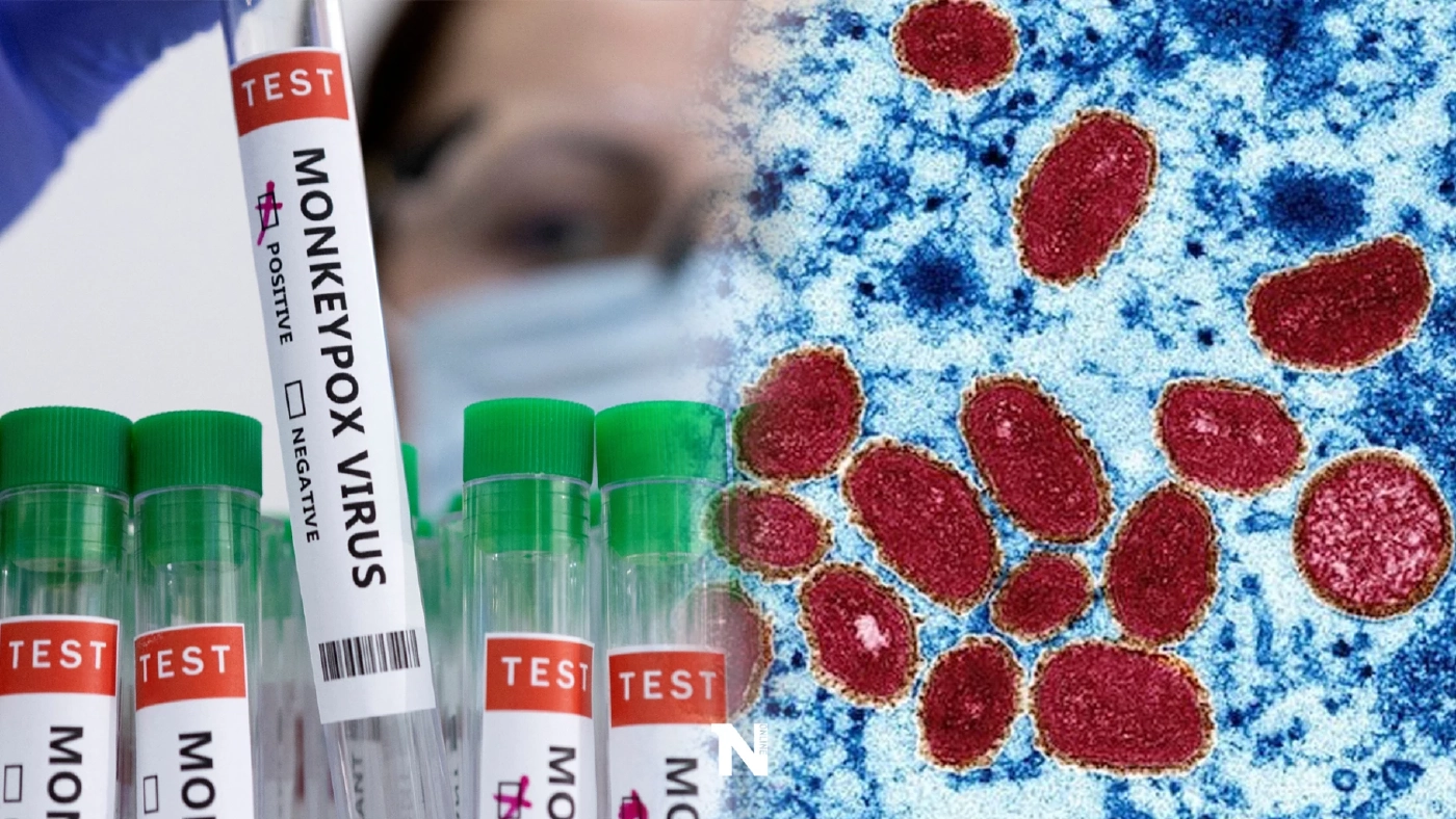 หมอยง เปิดข้อมูล "ฝีดาษลิง" เหตุใดตุ่มจึงขึ้นบริเวณอวัยวะเพศ และป้องกันยาก