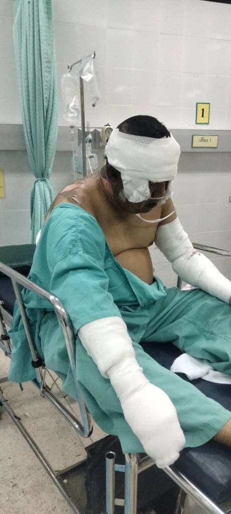 เหยื่อ Mountain B  เสียชีวิตเพิ่ม 1 ราย รวมเป็น 20 เจ้าของชดเชยให้ 3 หมื่นบาท