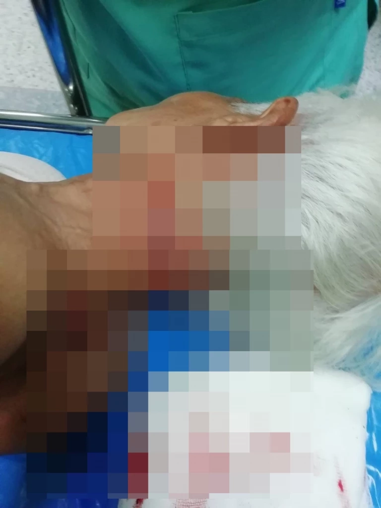 “ยายแขม” เย็บ 5 เข็มปลอดภัยแล้ว เปิดใจเล่านาทีระทึก “หนุ่มคลั่ง” ฟันคอ