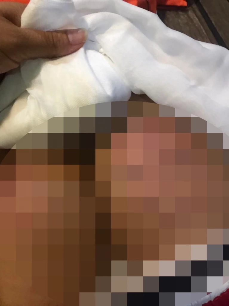 ครูโหด ตี นร.หญิง 14 ปี ก้นแตก เหตุติด ร. แต่ไม่ยอมแก้ แม่โวยเอาเรื่องถึงที่สุด