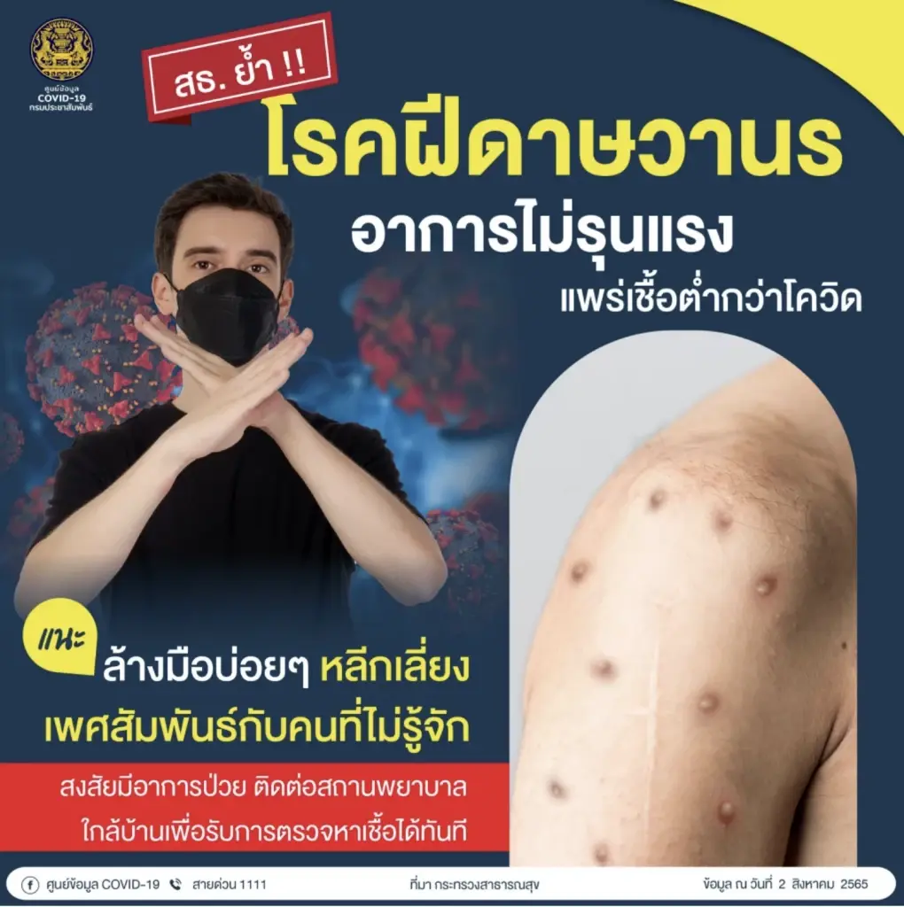 ลุ้น !! ผลตรวจชายชาวกินี ติดฝีดาษลิง หลังซื้อหญิงบริการข้าวสารแล้วตุ่มขึ้น