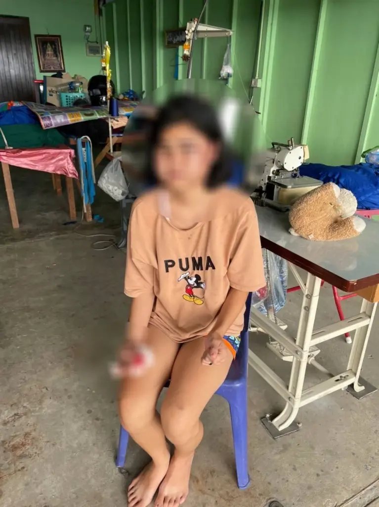 รักโหด! หนุ่มซ้อมภรรยาจนตาปูด ถึงขั้นตัดนิ้วพิสูจน์รัก