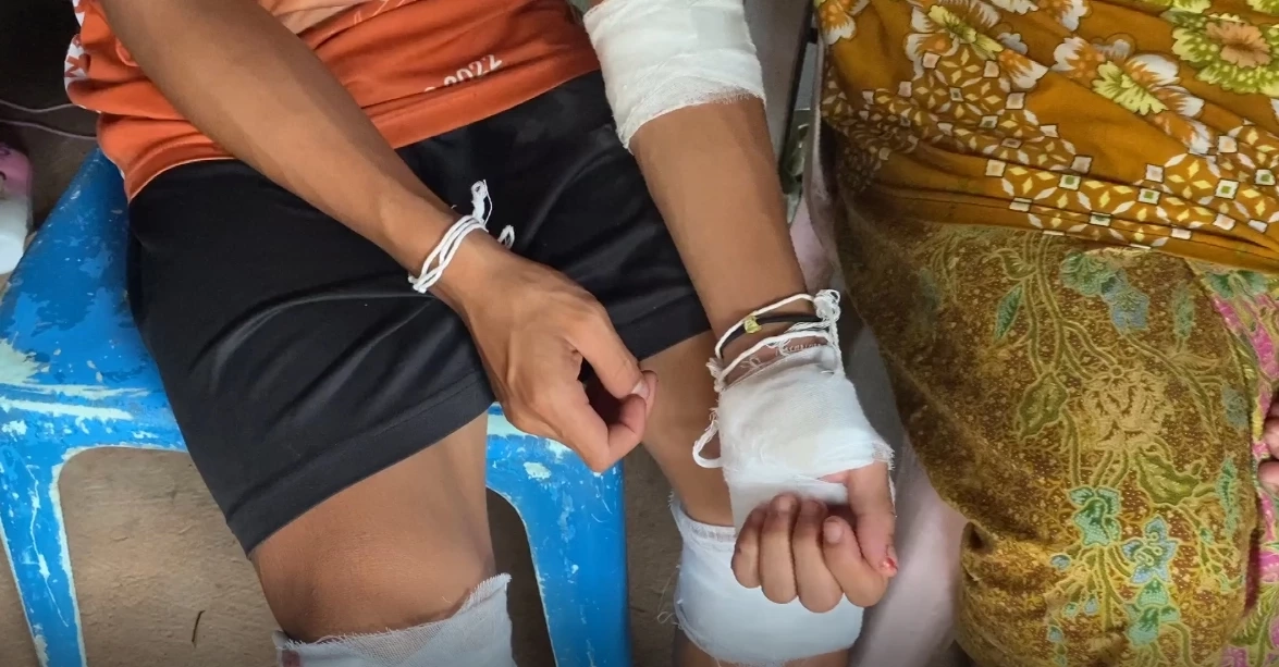 ถนนชุ่ยเป็นเหตุ !  เปิดคลิปนาทีชีวิต “เด็ก 14“  ขี่จยย. ตีลังกาไถลไกล 50 เมตร