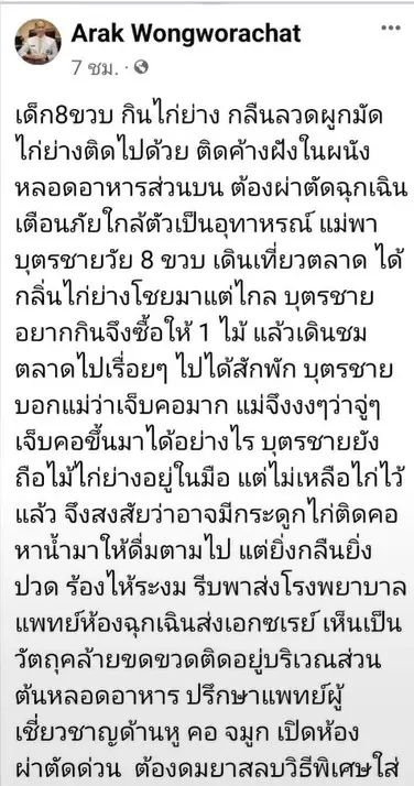 หมอโพสต์เตือนภัย "ลวดมัดไก่ย่าง" ติดคอเด็ก 8 ขวบ ต้องผ่าตัดฉุกเฉิน