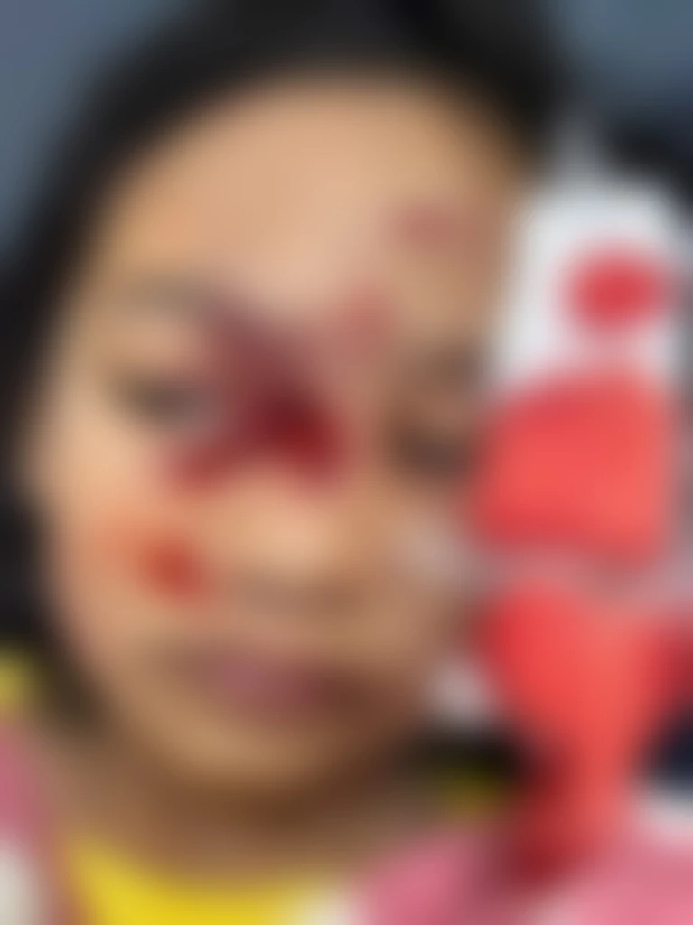 พ่อช็อกหมาขย้ำลูก 7 ขวบสาหัส เพื่อนบ้านยันไม่ใช่หมาตน-แค่ให้อาหาร