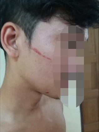 ร่องรอยบาดแผลผู้เสียหาย