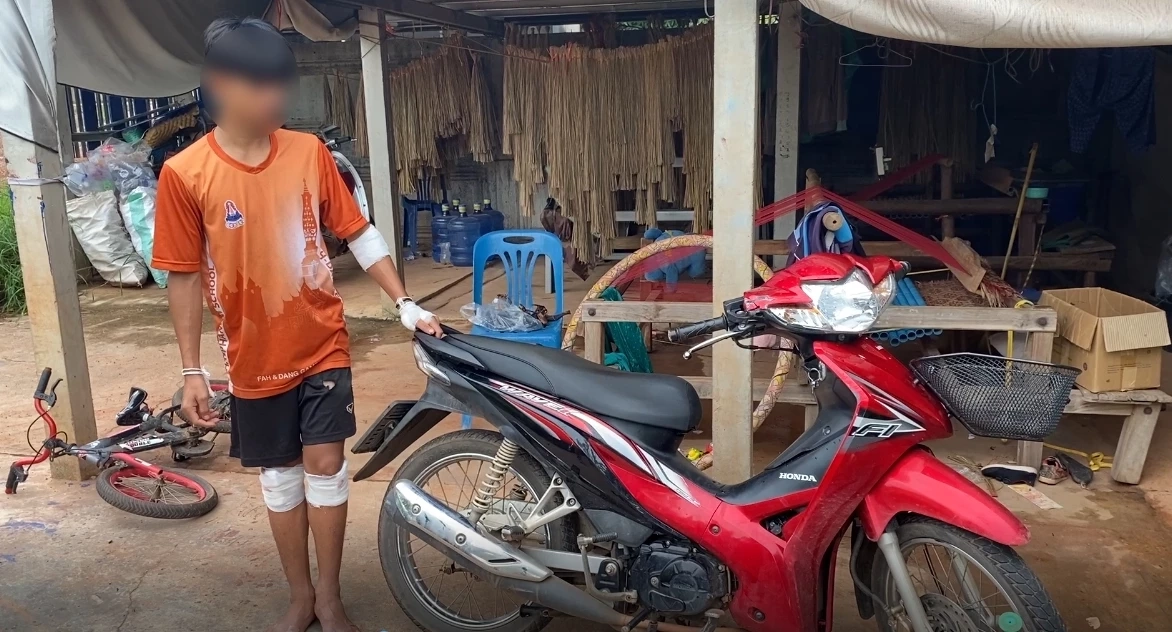 ถนนชุ่ยเป็นเหตุ !  เปิดคลิปนาทีชีวิต “เด็ก 14“  ขี่จยย. ตีลังกาไถลไกล 50 เมตร