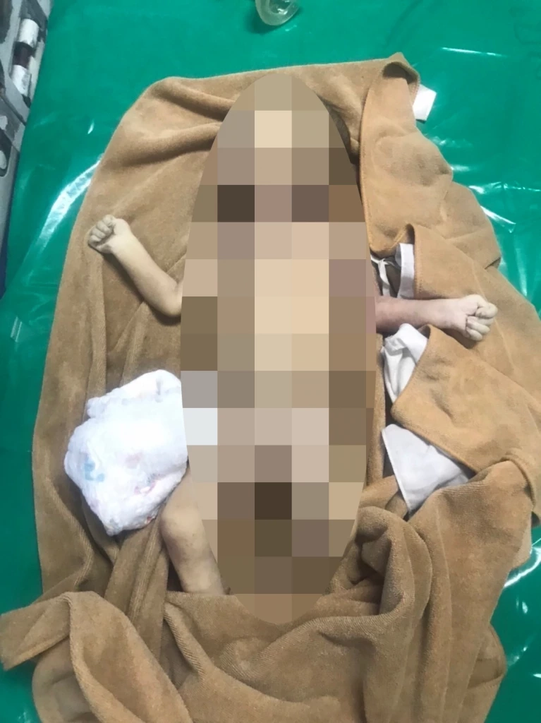 เศร้าใจ แม่ลูก 6 ใช้นมข้นหวานเลี้ยงลูกวัย 3 เดือน สุดท้ายเด็กน้อยเสียชีวิต