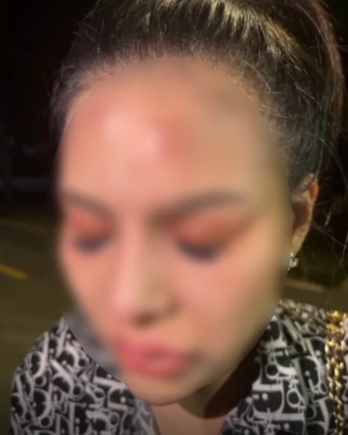 ผวา “สาวพีอาร์” ร้องถูก “แก๊งสาวสอง” รุมยำ ขู่ซ้ำรู้จักผู้ใหญ่ในจว. (มีคลิป)