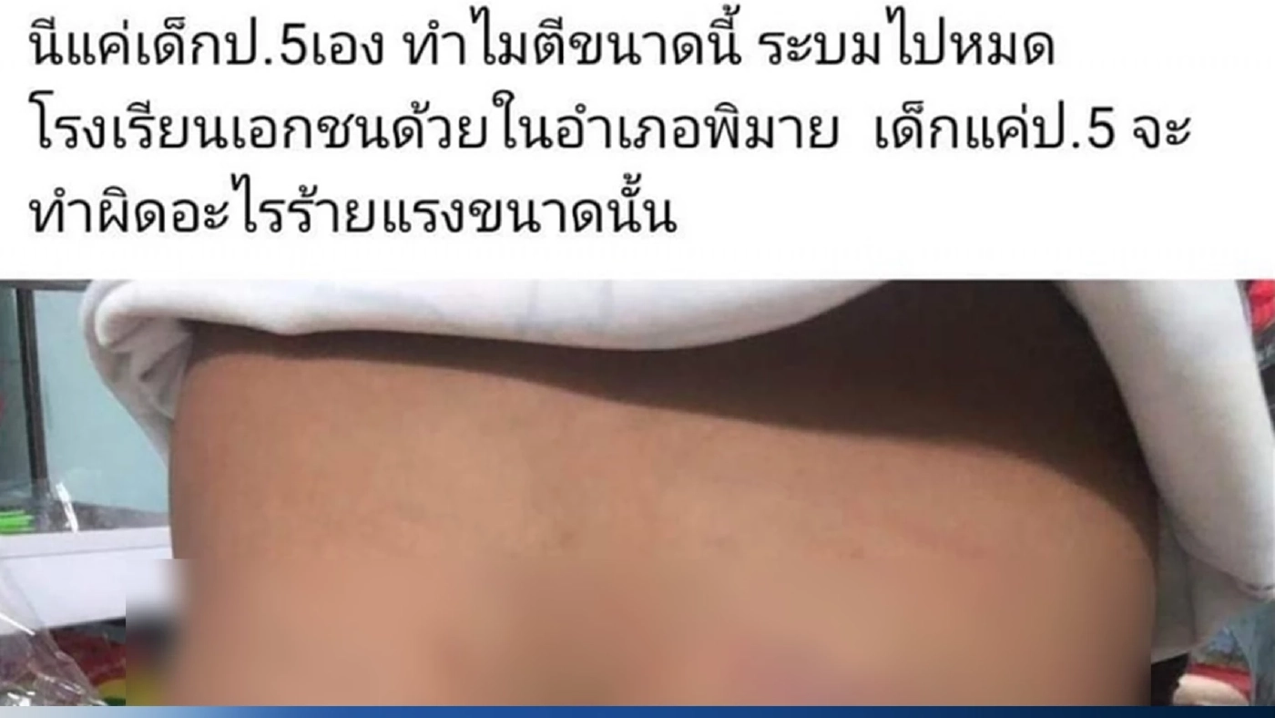 โผล่อีก! แม่ร้องครูเอกชนชื่อดังเมืองพิมาย ตีลูกชาย ป.5 ถึง 26 ครั้งจนก้นลาย