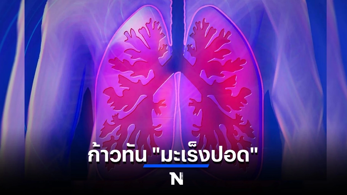 จับสัญญาณ "มะเร็งปอด" โรคร้ายที่คร่าชีวิต "ครูมืด" และคนดังไปมากมาย
