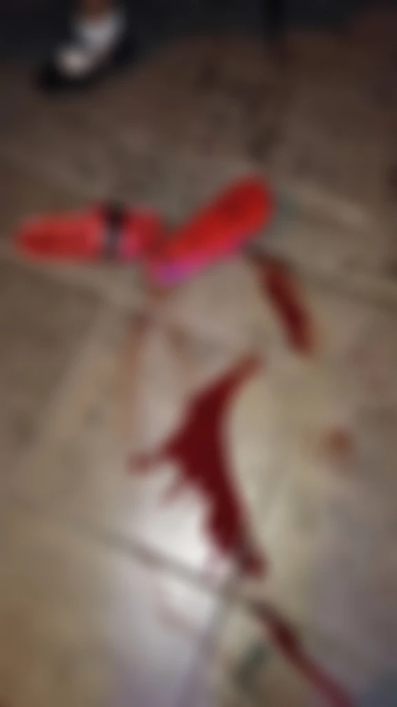 วัยรุ่น 2 ร.ร.ดัง ยกพวกถล่มกันเละ เคลียร์ปัญหาเรื่องผู้ชายไม่จบ เจ็บ 3