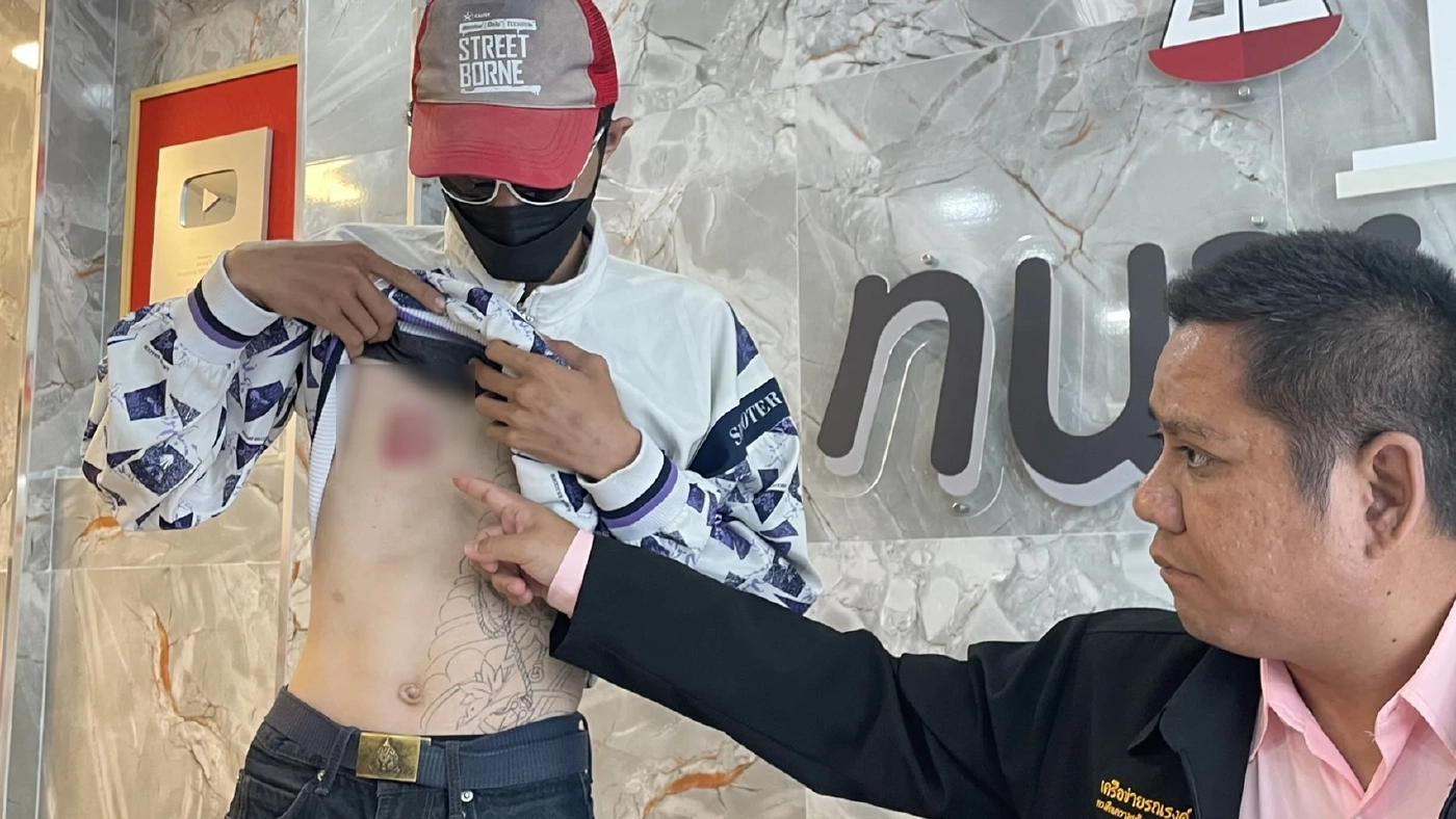 นักเรียนช่าง ขอความช่วยเหลือจาก ทนายรณณรงค์ หลังถูกนักเรียนต่างสถาบันทำร้ายร่างกาย