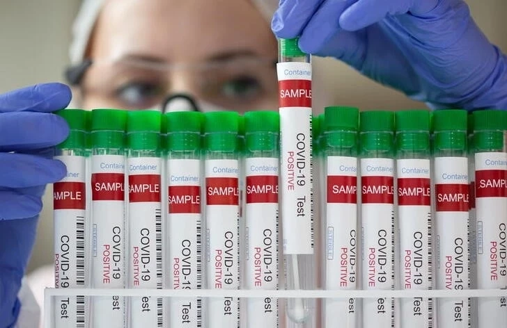 สสจ.ชลบุรีเผย ยอดติดโควิดรายใหม่ 148 ราย ATK ยอดทะลุหมื่น ล่าสุดดับ 6 ราย