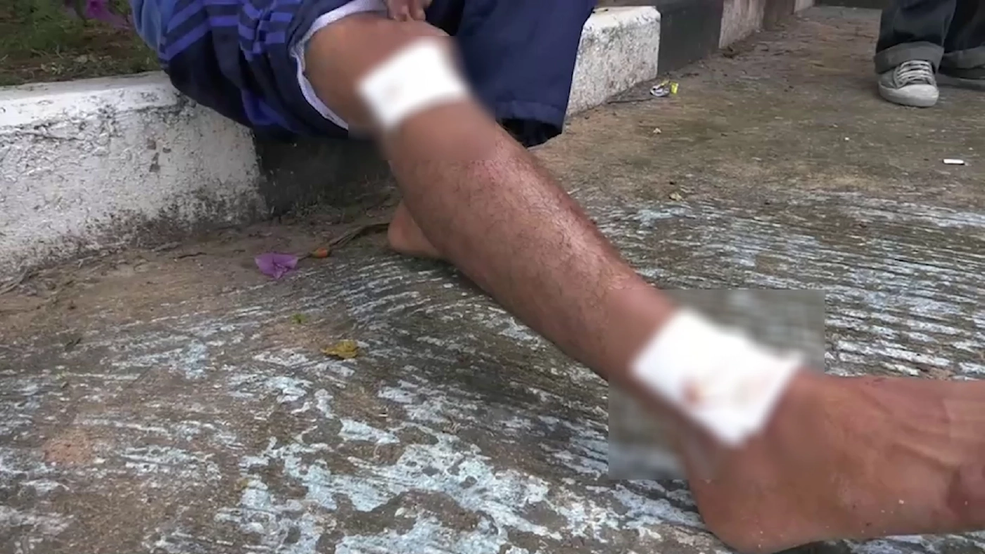 หนุ่ม ปวส. กลับจากดูรถแห่ ถูกอริรุมฟันดับ แม่ร่ำไห้ อีก 3 เดือน ลูกจะเรียนจบ