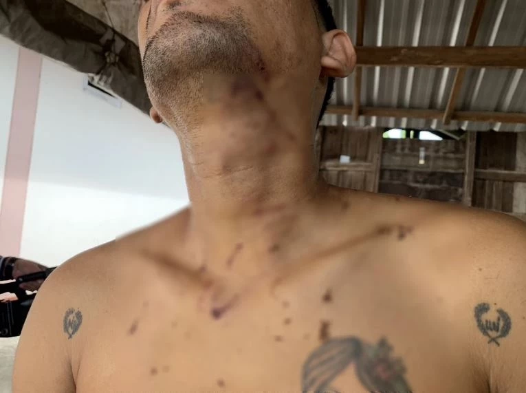 นายต้อ ผู้เสียหาย