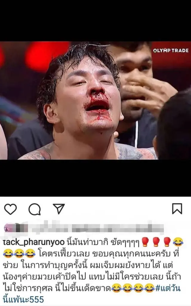 "แทค ภรัณยู" จมูกหักเข้ารับการผ่าตัด ผลออกมาเป็นที่น่าพอใจ