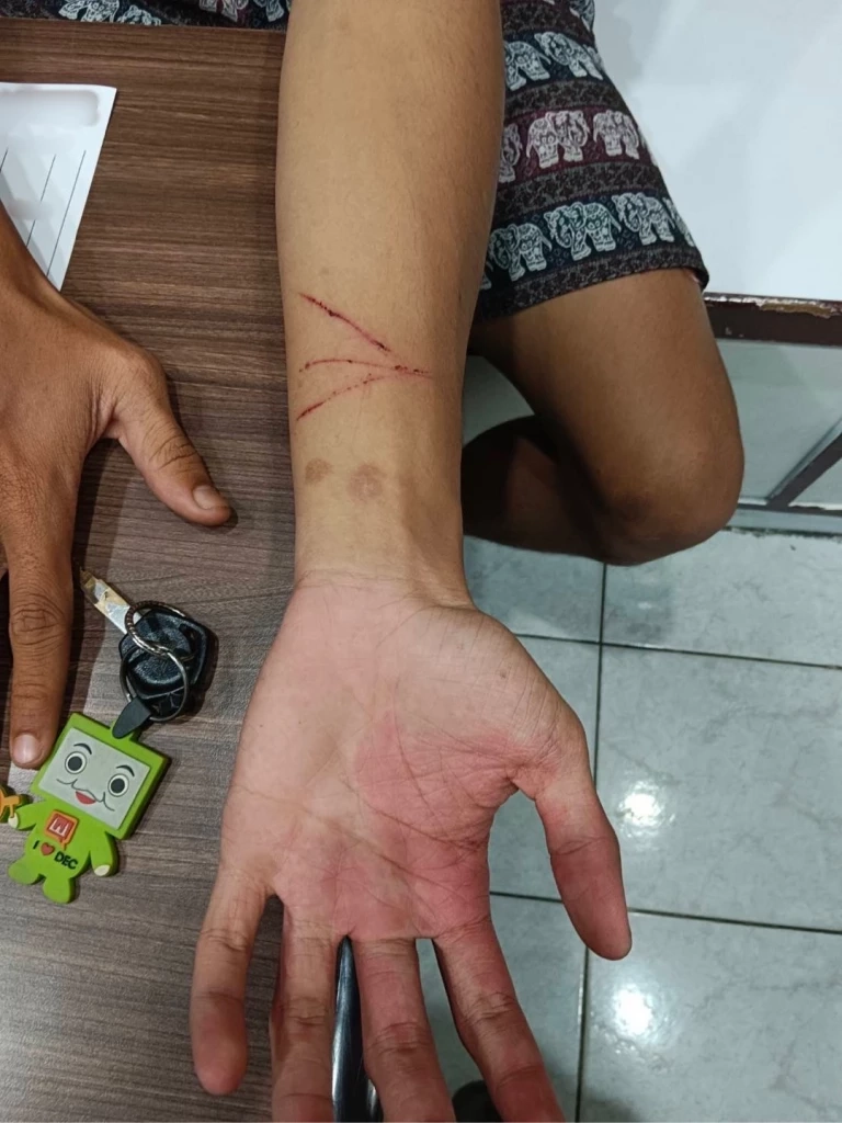 โอละพ่อ หนุ่ม 19 ถูกดักทำร้ายชิงทรัพย์ “โพธิ์แก้ว” ที่แท้กุเรื่อง