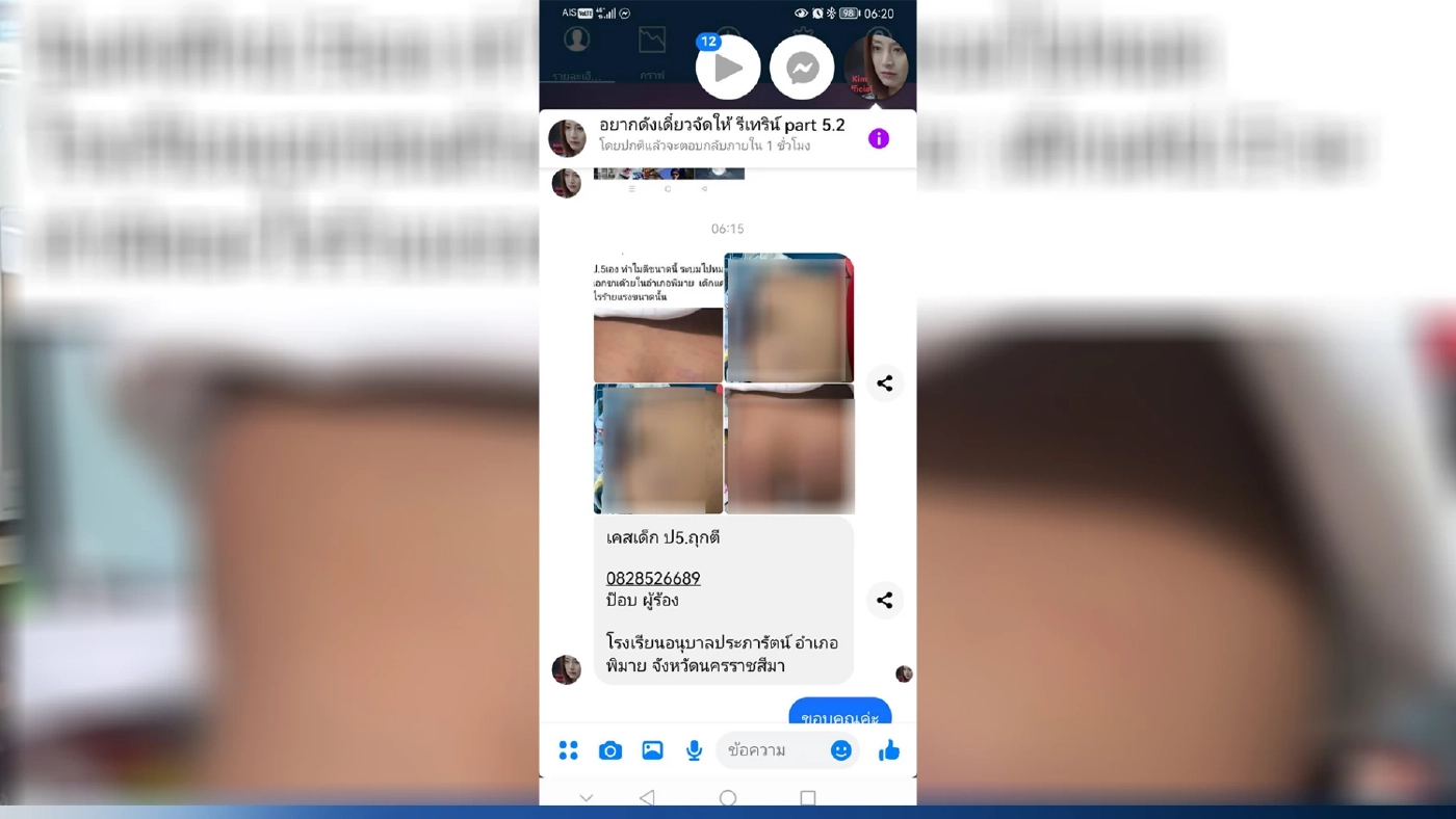 โผล่อีก! แม่ร้องครูเอกชนชื่อดังเมืองพิมาย ตีลูกชาย ป.5 ถึง 26 ครั้งจนก้นลาย