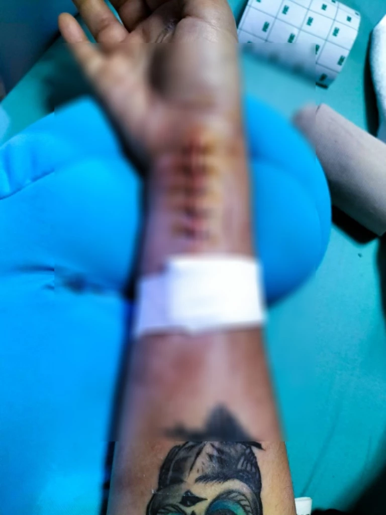 สาวร้อง! สจ.คนดัง จ.ปทุมธานี ทำร้ายแขนหัก ไม่รับผิดชอบ แถมขู่ดำเนินคดี