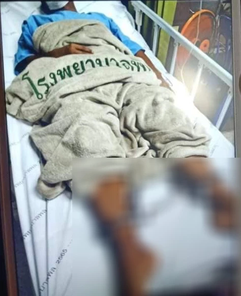 ระดมล่า! นักโทษชาย หลบหนีพร้อมโซ่ตรวน ขณะเข้ารักษาตัวที่ รพ.พล