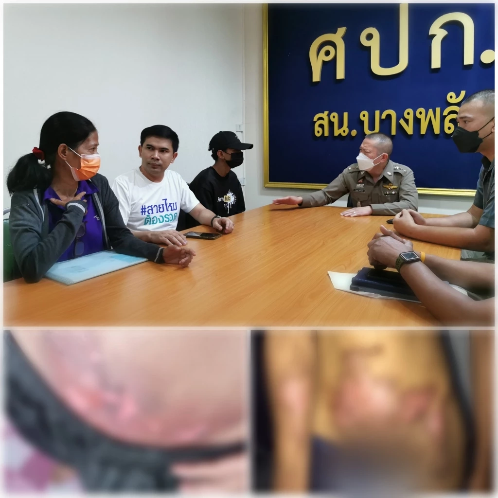 ตำรวจจ่อแจ้งข้อหารุ่นพี่ "รับน้องโหด" ใช้สีสเปรย์ฉีดจุดไฟเผาร่างเฟรชชี่