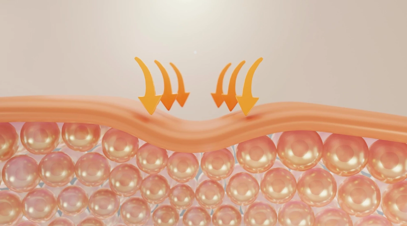 แนะ 6 เทคนิค กินอย่างไรให้ร่างกายสร้างคอลลาเจน