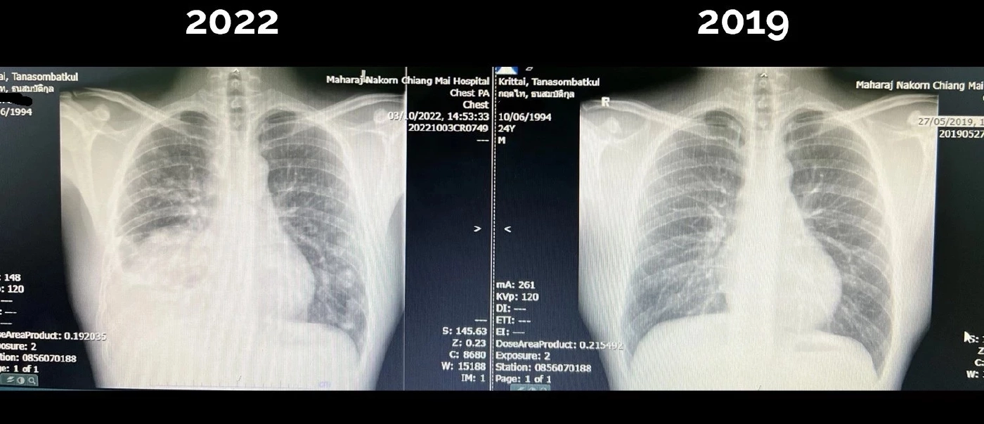 "นพ.กฤตไท" โพสต์สุดซึ้ง - ขอบคุณทุกๆ กำลังใจที่มอบให้ในครั้งนี้  