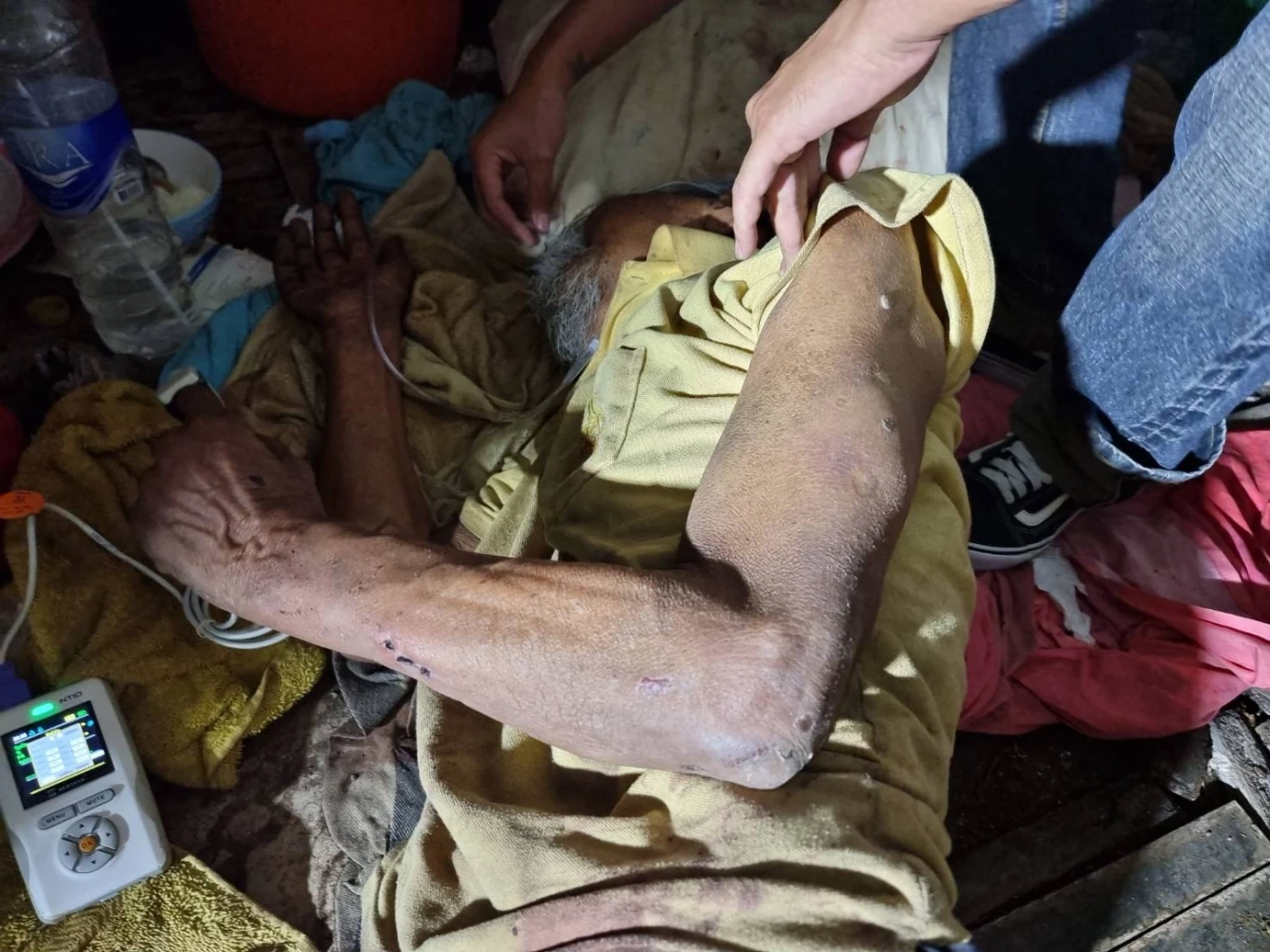 หลานเมากัญชา ทำร้ายตาวัย 80 ปี ชาวบ้านร้อง "เพจสายไหมต้องรอด" ช่วยเหลือ