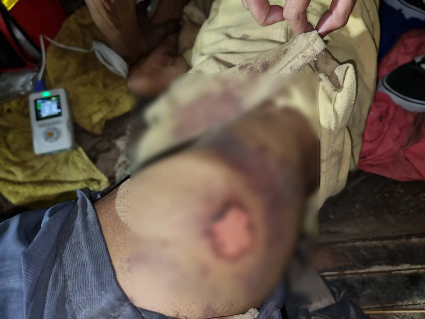 หลานเมากัญชา ทำร้ายตาวัย 80 ปี ชาวบ้านร้อง "เพจสายไหมต้องรอด" ช่วยเหลือ