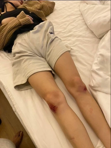 สภาพดีเจสาวหลังดื่มเครื่องดื่มปริศนา