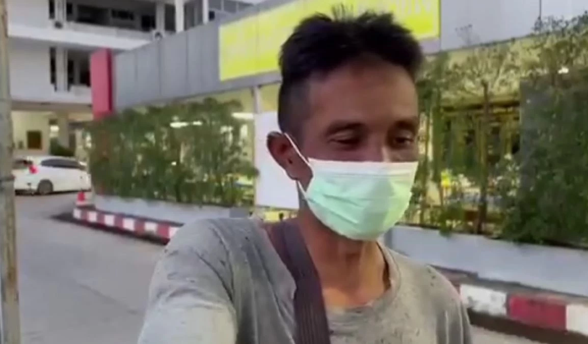 หวาดเสียว! หนุ่มดวงซวยทำปืนยิงปลาลั่น ลูกดอกปักแก้มทะลุจมูก