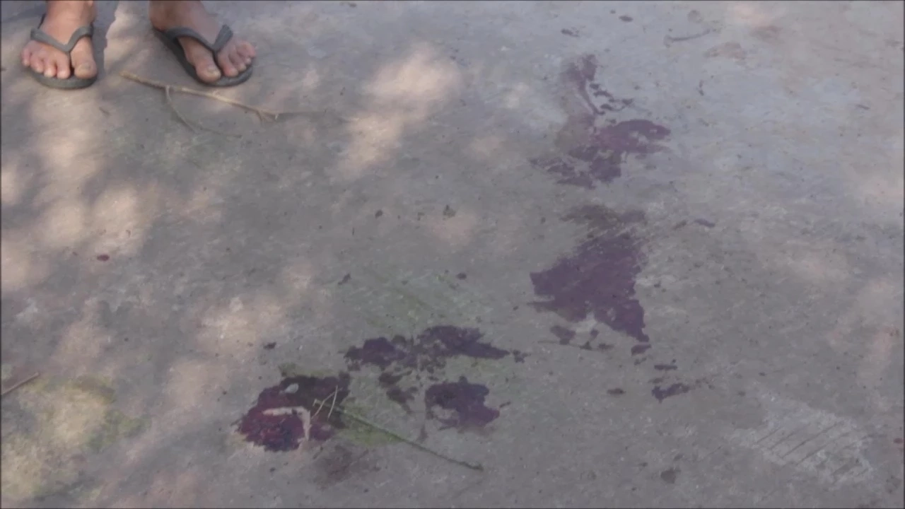 อีกราย! หนุ่มอุดร วัย 47 ปี ถูกสุนัขพิตบูลเพื่อนบ้าน รุมขย้ำดับ