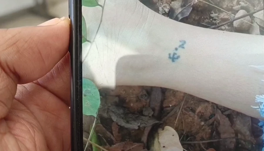 ตำหนิบนร่างผู้เสียชีวิต