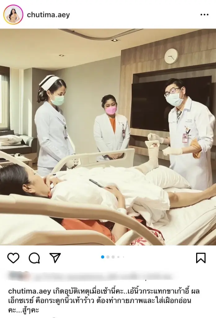 ฟาดเคราะห์ “เอ้ ชุติมา”  ประสบอุบัติเหตุ เจ็บหนัก ถึงขั้นทำกายภาพ