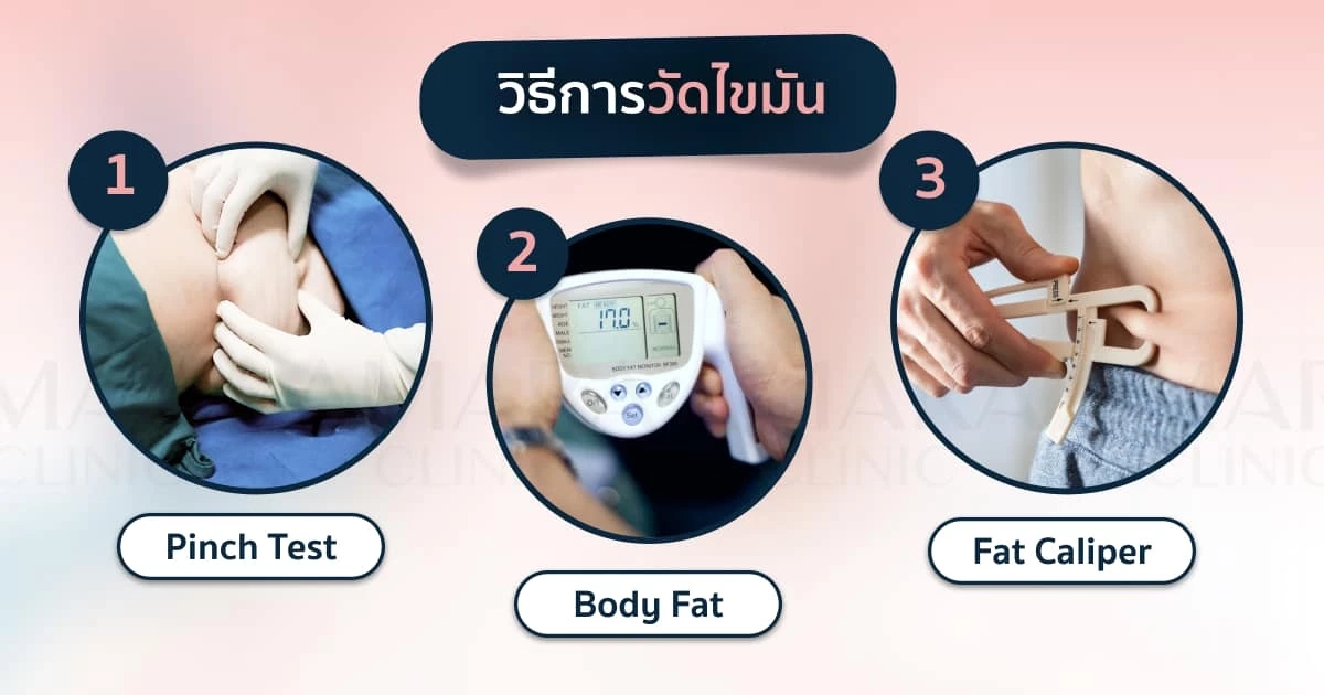 ดูดไขมันเหมาะกับใครบ้าง 